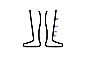 icon showing abnormal hair growth
