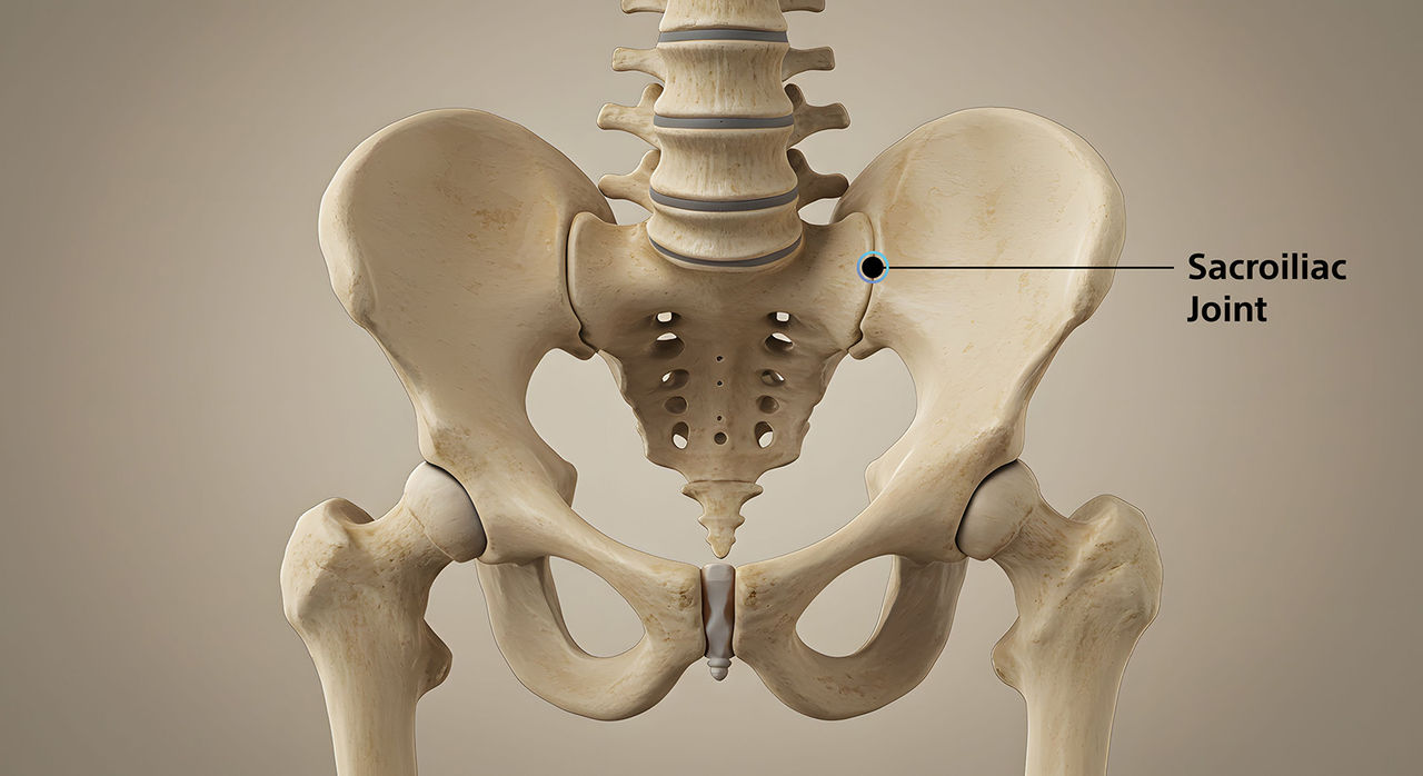 Sacroiliac Joint Dysfuntion