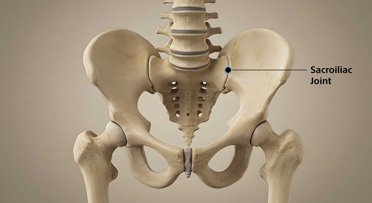 Sacroiliac Joint Dysfunction Causes Symptoms Treatment Control 